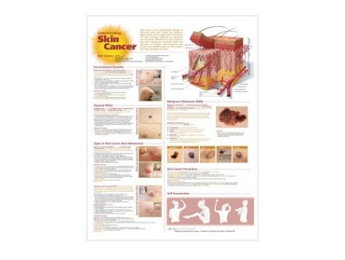 BODYLINE UNDERSTANDING SKIN CANCER CHART