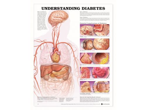 BODYLINE UNDERSTANDING DIABETES CHART