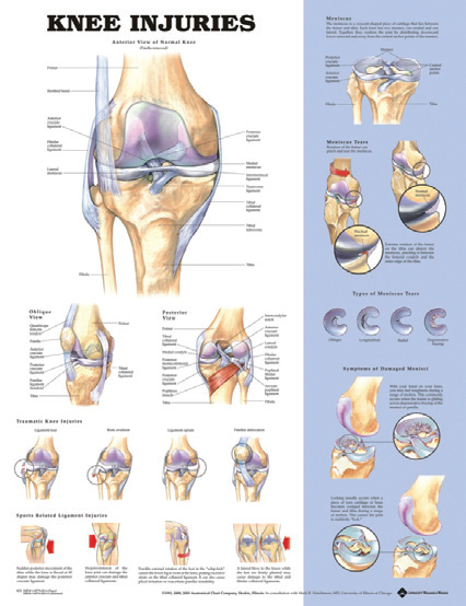 BODYLINE KNEE INJURIES CHART - LAMINATED photo