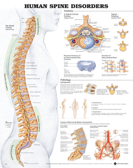 BODYLINE HUMAN SPINE DISORDERS CHART - LAMINATED photo