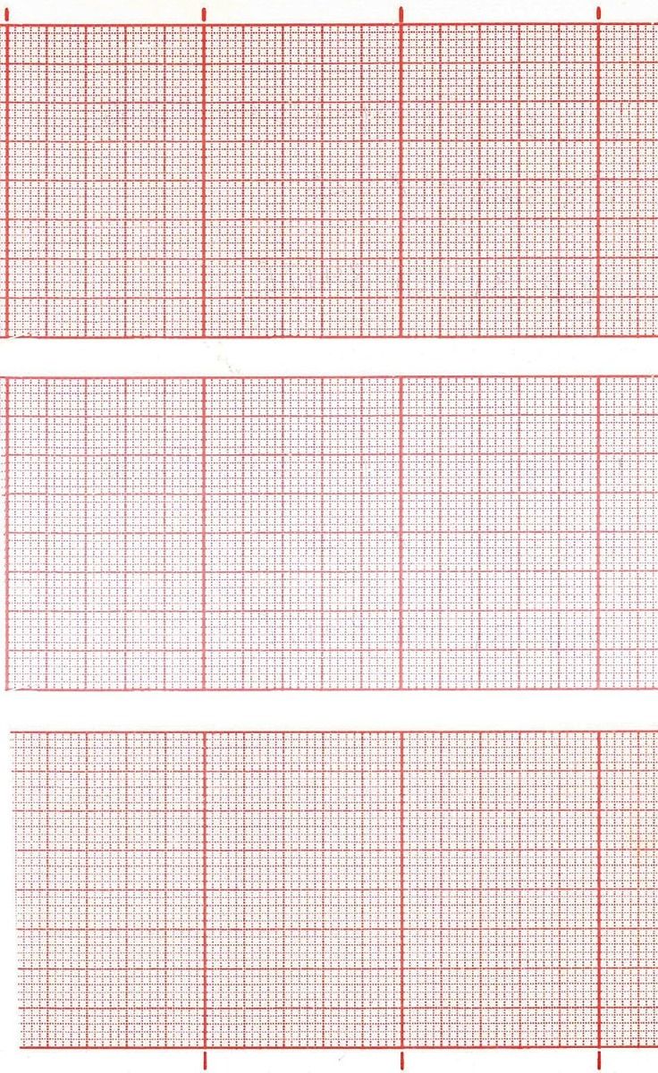 ECG PAPER ROLL FUKUDA / 145MM X 30M photo