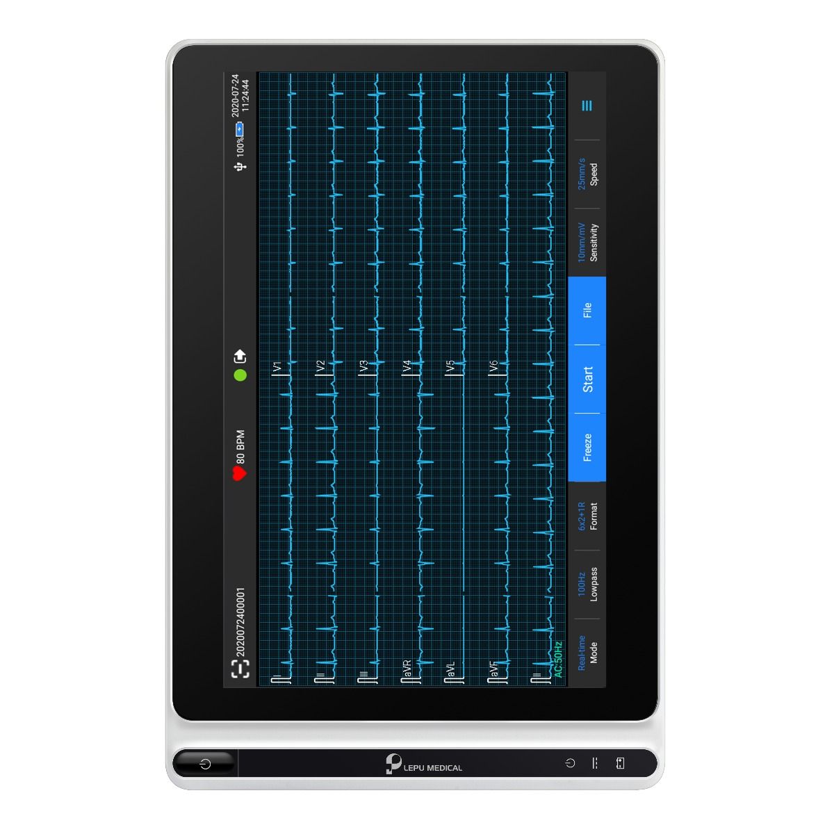 NEO ECG S120/OS12 ECG TABLET photo