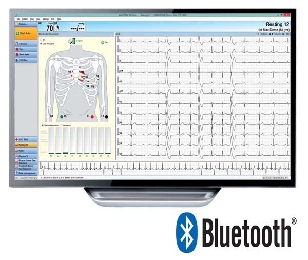 AMEDTEC ECG PC BASED / 12 LEAD ECG / BLUETOOTH photo