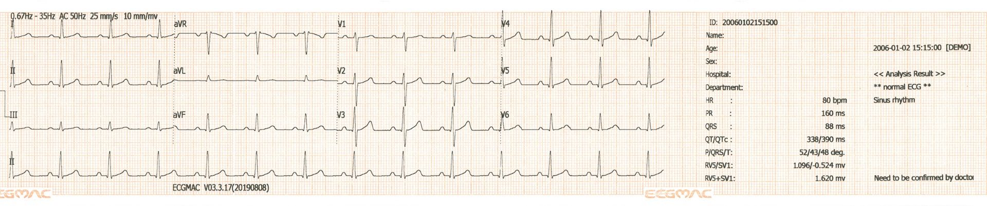 THREE CHANNEL ECG PAPER FOR EM-301 / 80MM X 20MM / 1 ROLL photo