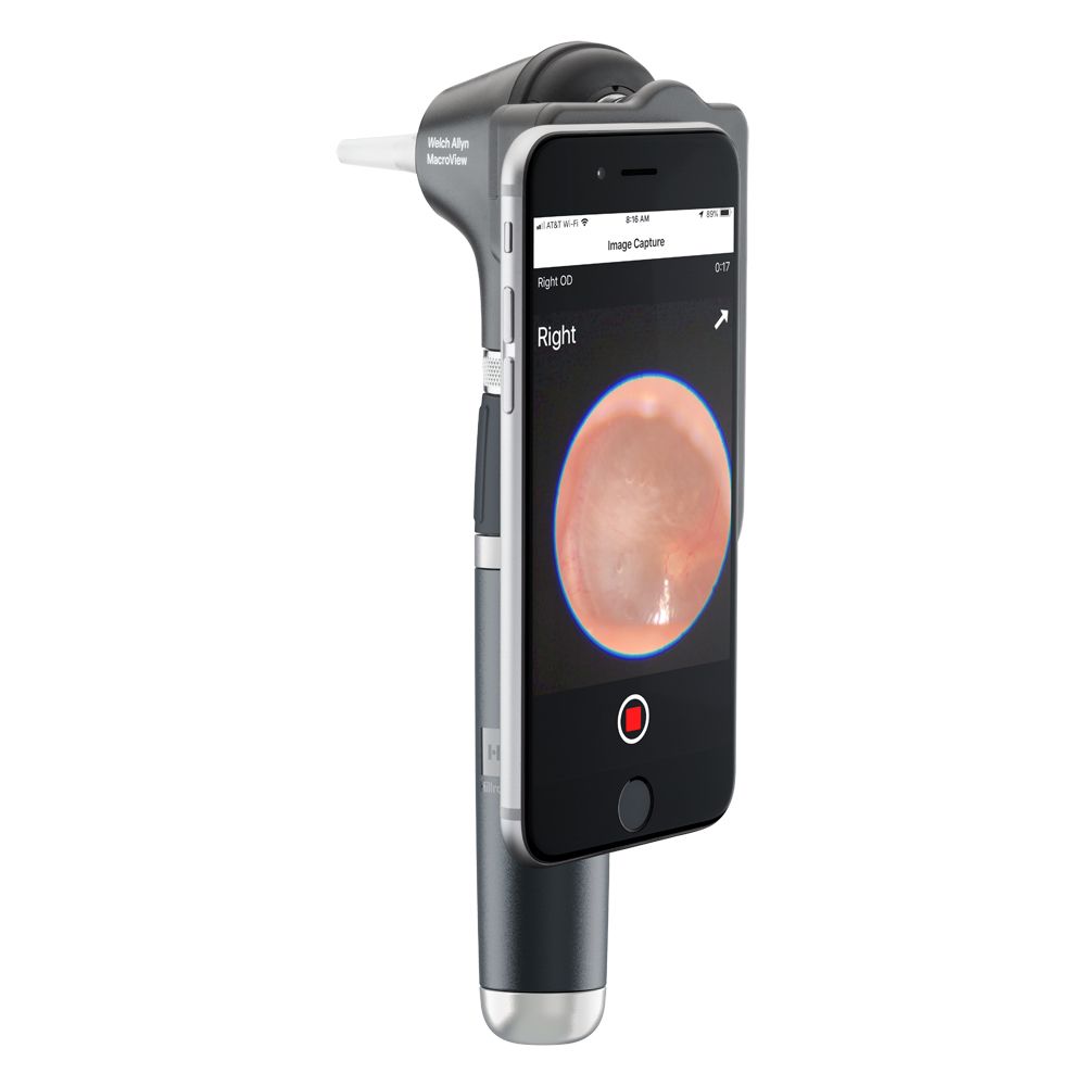 MACROVIEW OTOSCOPE HEAD / PLUS photo
