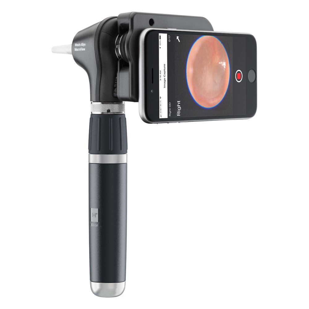 MACROVIEW OTOSCOPE HEAD / PLUS photo