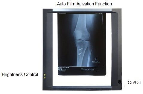 X-RAY VIEWER  (1Bay) Slimline LED photo