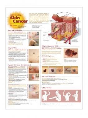 BODYLINE UNDERSTANDING SKIN CANCER CHART