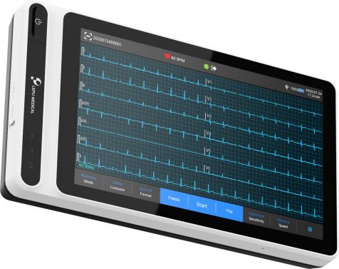 NEO ECG S120 ECG TABLET