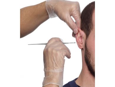 PROPULSE PROSCOOP EAR WAX REMOVAL SCOOP / PACK OF 40